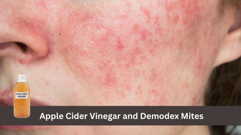Photo inspiration: Fresh Look at Does Apple Cider Vinegar Kill Demodex Mites On Humans