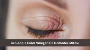 Photo inspiration: Apple Cider Vinegar For Demodectic Mange Reference: Does Apple Cider Vinegar Kill Demodex Mites On Humans