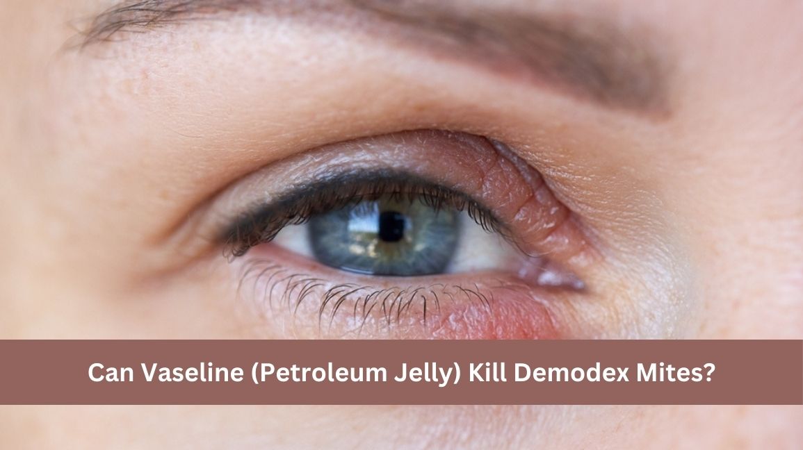 Does Vaseline Kill Demodex Mites? Its MAM